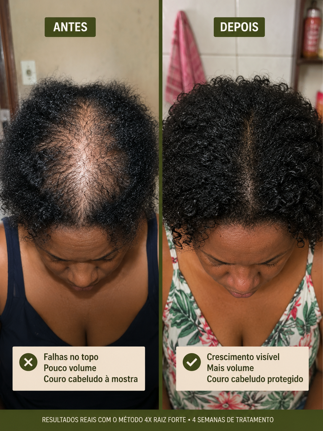 Antes e depois mulher negra